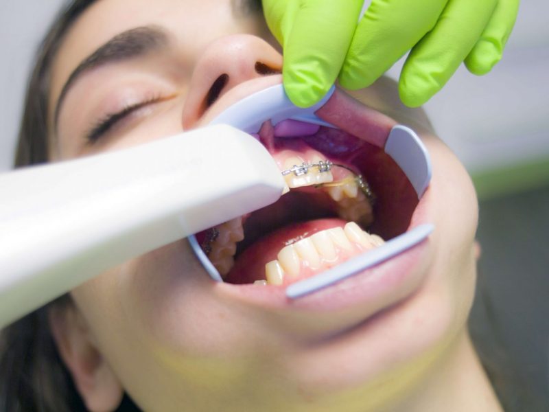 Ağız Ve Diş Sağlığında Mükemmellik İçin Diş Kliniği Seçimi Önemli